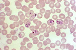 Journal club on malaria study published in FEBS Letters - A Junior Ambassador activity