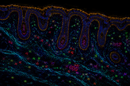 The Future of Oncology: From Detection to Interception