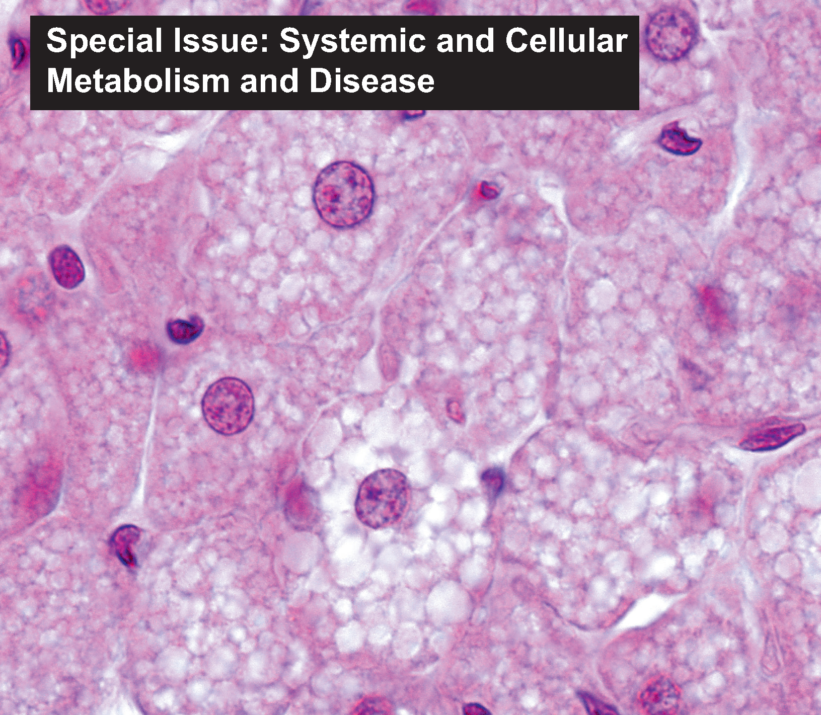 Special Issue: Systemic and Cellular Metabolism and Disease