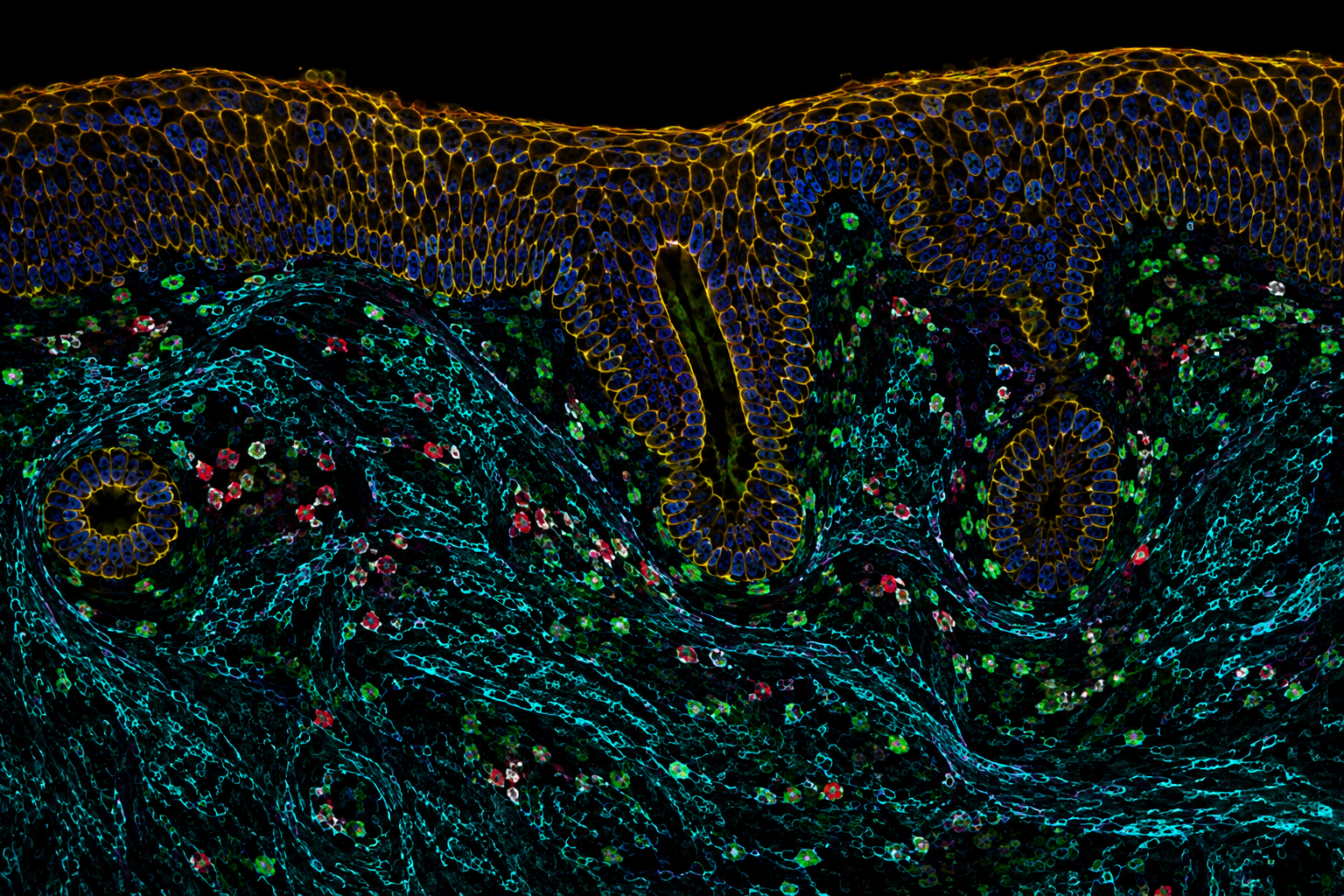 Designing A World That Refuses to Seed Cancer: A 2050 Perspective