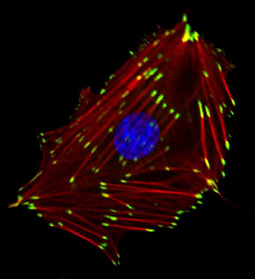 Highlights from The FEBS Journal - October 2017