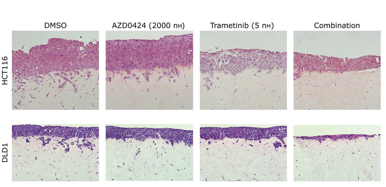 Mapping multiple routes for effective kinase inhibition in cancer