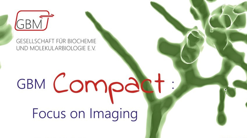Successful GBM Compact Meeting "Focus on Imaging"
