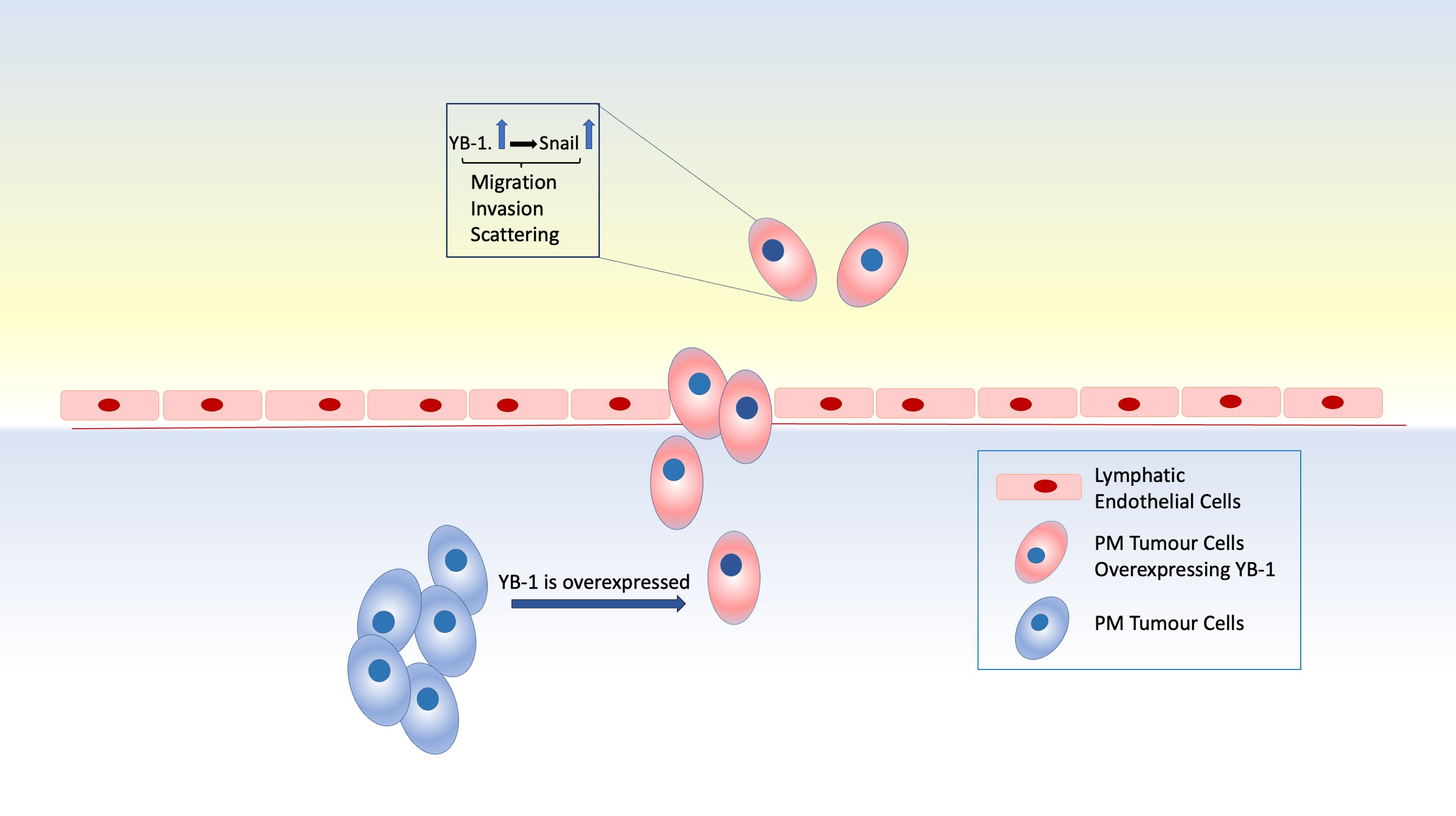Shedding light on key genes behind aggressive phenotype of pleural mesothelioma