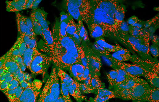 A FEBS Advanced Lecture Course on Oncometabolism: From Conceptual Knowledge to Clinical Applications – September 2019; Luso, Portugal