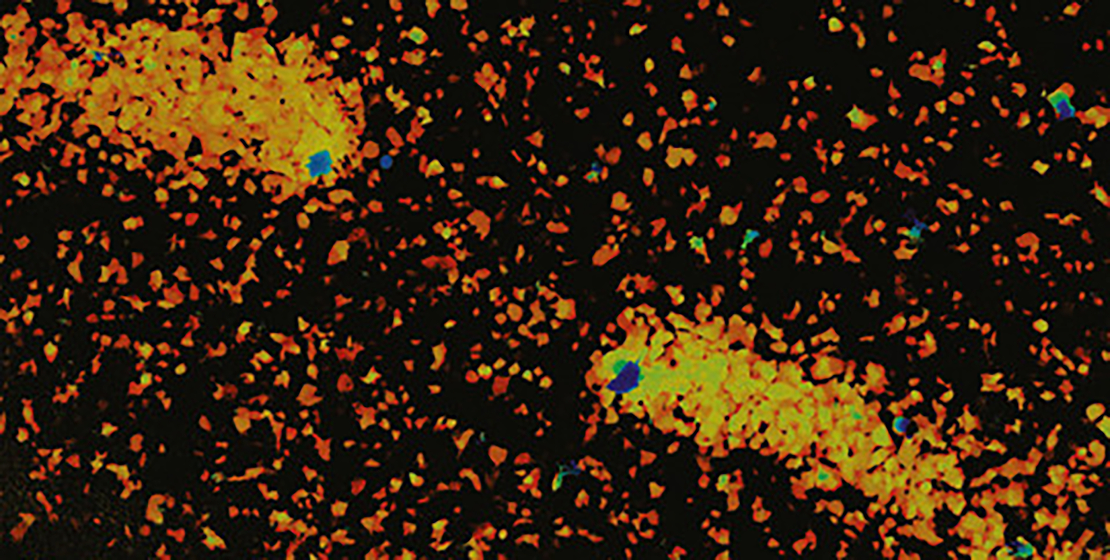 Adenoviruses: Biology, Disease and Therapy